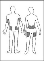 محل‌های مناسب برای تزریق انسولین